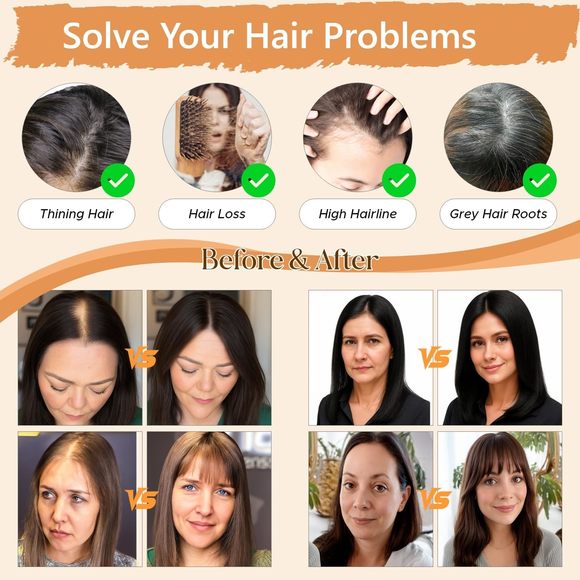 Human Hair Topper For Women, 3d Cover Clip In Bangs, Hair Toppers With Side🤘